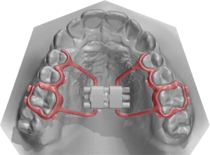 3D Model of a Hyrax expander